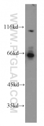 15305-1-AP - ATP6AP1