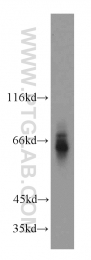 15305-1-AP - ATP6AP1