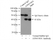 18274-1-AP - ATP6V0D1