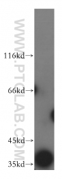 18274-1-AP - ATP6V0D1