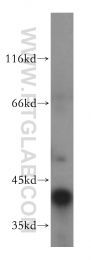 18274-1-AP - ATP6V0D1
