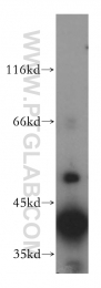 18274-1-AP - ATP6V0D1