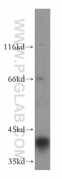 18274-1-AP - ATP6V0D1
