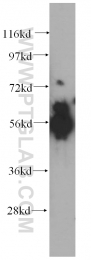 14780-1-AP - ATP6V1B1