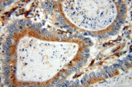 15097-1-AP - ATP6V1B2