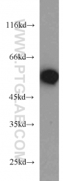 15097-1-AP - ATP6V1B2