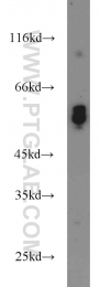 15097-1-AP - ATP6V1B2