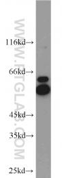 15097-1-AP - ATP6V1B2