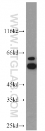 15097-1-AP - ATP6V1B2