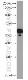15097-1-AP - ATP6V1B2
