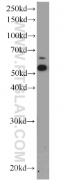 15097-1-AP - ATP6V1B2