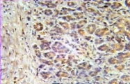 10297-1-AP - Aurora kinase A