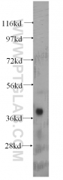60098-1-Ig - Aurora kinase B