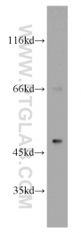 14177-1-AP - B3GALT2
