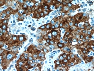 55049-1-AP - B3GALT6