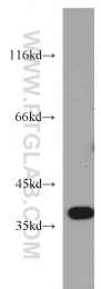 55049-1-AP - B3GALT6