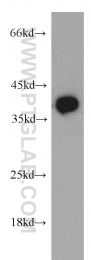 55049-1-AP - B3GALT6