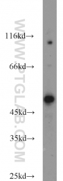 22879-1-AP - B3GNT7