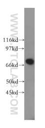 13396-1-AP - B4GALNT1