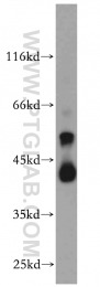 20330-1-AP - B4GALT2