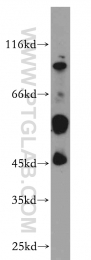 20330-1-AP - B4GALT2