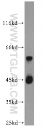 20330-1-AP - B4GALT2