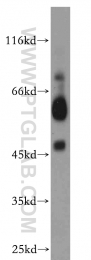 20330-1-AP - B4GALT2