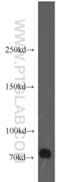 12807-1-AP - BACE1