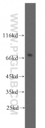 12807-1-AP - BACE1