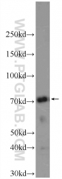 10599-1-AP - BAG3