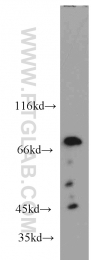 10599-1-AP - BAG3