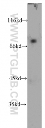 10599-1-AP - BAG3