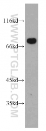 10599-1-AP - BAG3