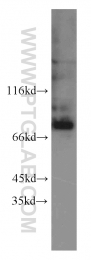 10599-1-AP - BAG3