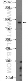 22964-1-AP - BARD1