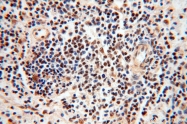 17254-1-AP - BBX / HBP2