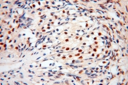 17254-1-AP - BBX / HBP2