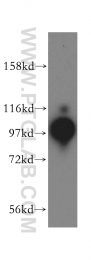17254-1-AP - BBX / HBP2