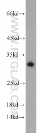 10414-1-AP - BCAS2 / DAM1