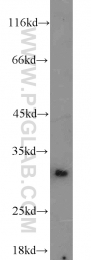 10414-1-AP - BCAS2 / DAM1