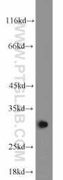 10414-1-AP - BCAS2 / DAM1
