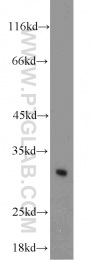 10414-1-AP - BCAS2 / DAM1