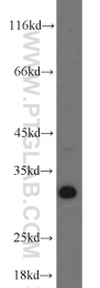 10414-1-AP - BCAS2 / DAM1