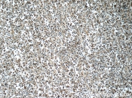 13640-1-AP - BCAT1