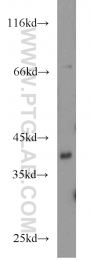 16417-1-AP - BCAT2