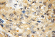 11613-1-AP - Bcl-11A