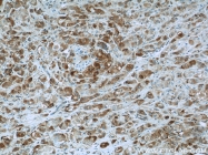 21969-1-AP - Bcl-2-like 12