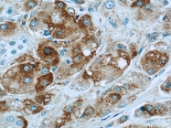 21969-1-AP - Bcl-2-like 12