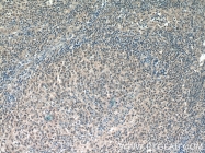 23959-1-AP - Bcl-3