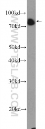 21187-1-AP - Bcl-6